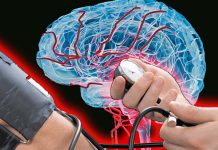 High blood pressure accelerates brain aging