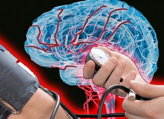 High blood pressure accelerates brain aging