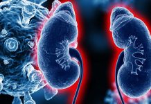 Kidney transplant patients are at risk for all kinds of infections
