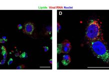 Lipids play a vital role in SARS-CoV-2 replication and in the human immune response