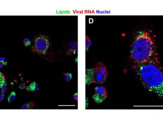 Lipids play a vital role in SARS-CoV-2 replication and in the human immune response