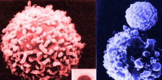 Natural killer cells (NK cells) play an important role in immune surveillance against tumors