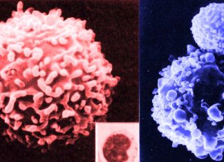Natural killer cells (NK cells) play an important role in immune surveillance against tumors