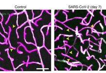 SARS-CoV-2 – la principale proteasi mpro causa la patologia cerebrale microvascolare