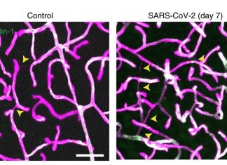 SARS-CoV-2 – la principale proteasi mpro causa la patologia cerebrale microvascolare