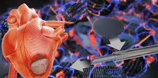 A new cardiac patch made by gelatin – carbon nanotube – cardiac cells could restore function to a damaged heart following a cardiac arrest