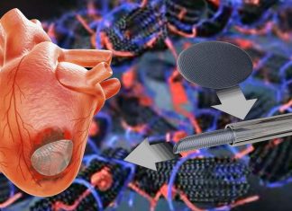 A new cardiac patch made by gelatin – carbon nanotube – cardiac cells could restore function to a damaged heart following a cardiac arrest