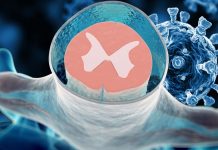 Neurologists found replicable SARS-CoV-2 RNA in CSF of asymptomatic patients after 114 days