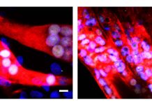 Diabete di tipo 2: una somministrazione di cellule muscolari ingegnerizzate può curare il diabete per quattro mesi