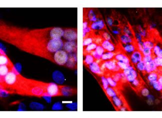 Diabete di tipo 2: una somministrazione di cellule muscolari ingegnerizzate può curare il diabete per quattro mesi