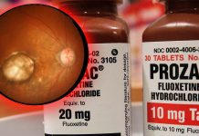 Il Prozac potrebbe offrire il primo trattamento contro la degenerazione maculare atrofica legata all’età