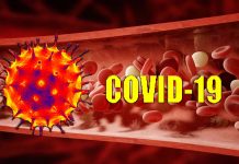 COVID-19: il trattamento di pazienti con alte dosi di eparina a basso peso molecolare (LMWH) ha ridotto significativamente il potenziale di formazione di coaguli e morte