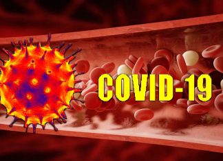 COVID-19: il trattamento di pazienti con alte dosi di eparina a basso peso molecolare (LMWH) ha ridotto significativamente il potenziale di formazione di coaguli e morte