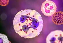 Severe COVID-19: Researchers have discovered a unique role of neutrophils in the pathogenesis of the disease