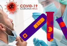 COVID-19: qual è la differenza tra i test a flusso laterale (LFT) e la PCR?