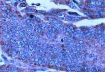 Inhibiting or genetically deleting the enzyme MTHFD2 reduce disease severity in multiple inflammatory disease
