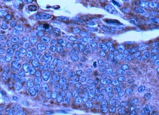 Inhibiting or genetically deleting the enzyme MTHFD2 reduce disease severity in multiple inflammatory disease