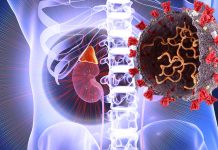 SARS-CoV-2 Targets And Causes Cellular Damage To Adrenal Glands