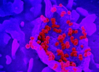 SARS-CoV-2 Coronavirus Can Infect And Replicate In Human Host Neurons