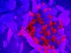 SARS-CoV-2 Coronavirus Can Infect And Replicate In Human Host Neurons