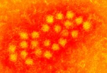 Torquetenovirus (TTV) load in people infected by SARS-CoV-2 can be used as a marker of COVID-19 severity and recovery