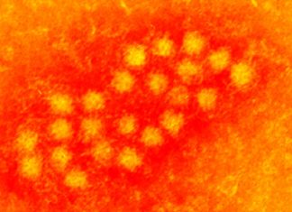 Torquetenovirus (TTV) load in people infected by SARS-CoV-2 can be used as a marker of COVID-19 severity and recovery