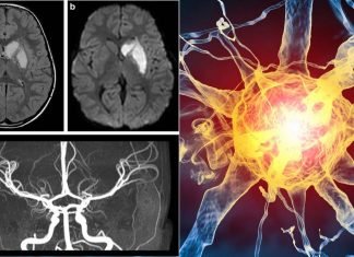 Teenagers infected with COVID-19 can develop CNS autoimmunity after recovery