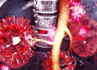 SARS-CoV-2 Can Directly Invade Human Kidney Causing Acute Injury