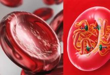 A Finnish study showed that low hemoglobin levels are associated with a lower body mass index and better metabolic health
