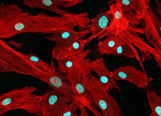 The therapeutic benefit to patients receiving mesenchymal stromal cell (MSC)