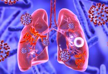 COVID-19 sta riattivando la tubercolosi dormiente negli individui, compresi i bambini