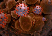 Calcium Channel Blockers Could Be Potential COVID-19 Drugs