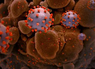 Calcium Channel Blockers Could Be Potential COVID-19 Drugs