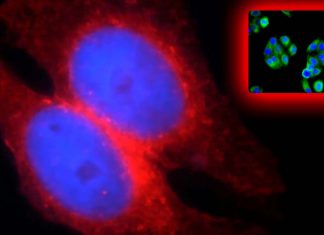 SARS-CoV-2 VOCs Dependent On IFITM2 For Replication