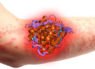 The skin is the Ground Zero for allergic disease