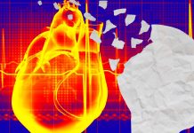 Older people who experience elevated heart rates are at increased risk for developing dementia