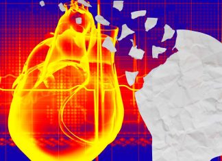 Older people who experience elevated heart rates are at increased risk for developing dementia