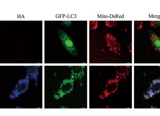 SARS-CoV-2 ORF10 Causes Break Down Of Mitochondrial Antiviral Signaling Protein (MAVS), Suppressing Host Immune Response