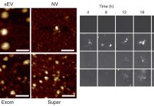 Supermere: A nanoparticle associated with multiple cancers – cardiovascular disease – Alzheimer’s disease and even COVID-19