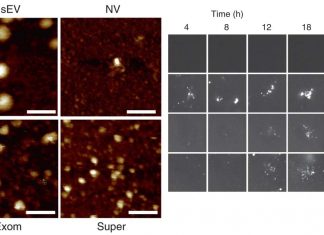 Supermere: A nanoparticle associated with multiple cancers – cardiovascular disease – Alzheimer’s disease and even COVID-19