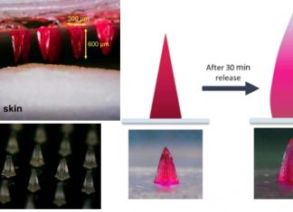 A breakthrough in microneedle patches