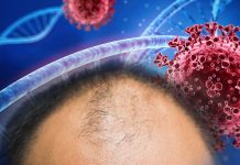 Balding Men Have A Higher Risk Of Developing Severe COVID-19