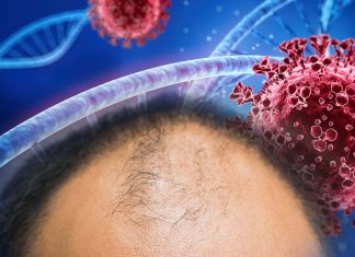 Balding Men Have A Higher Risk Of Developing Severe COVID-19