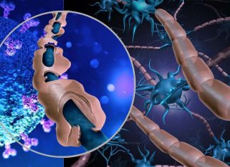 COVID-19: J&J Vaccine Is Linked To Increased Risk Of Guillain-Barré Syndrome