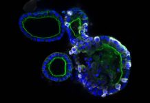 SARS-CoV-2 Persists In Intestinal Enterocytes Up To 7 Months After Symptom Resolution