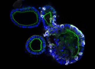 SARS-CoV-2 Persists In Intestinal Enterocytes Up To 7 Months After Symptom Resolution