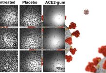 SARS-CoV-2 transmission: a chewing gum can reduce viral load