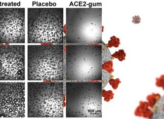 SARS-CoV-2 transmission: a chewing gum can reduce viral load