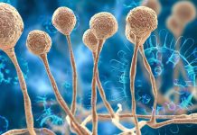 Deadly mucormycosis known as ‘black fungus’ disease spotted in Americans with COVID-19