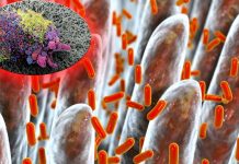A high-fiber diet improve gut microbiota and the response of melanoma patients to immunotherapy